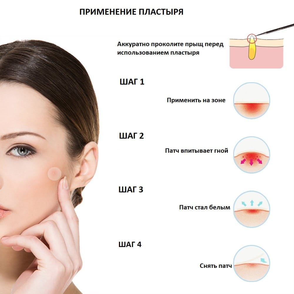 Пластир від прищів Acne Patch – фото 1
