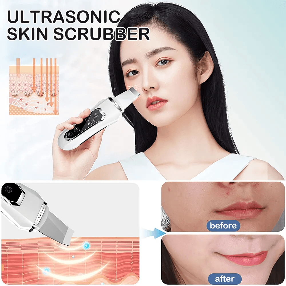 Ультразвуковий скрабер для обличчя Ultrasonic Facial Beauty Device – фото 4