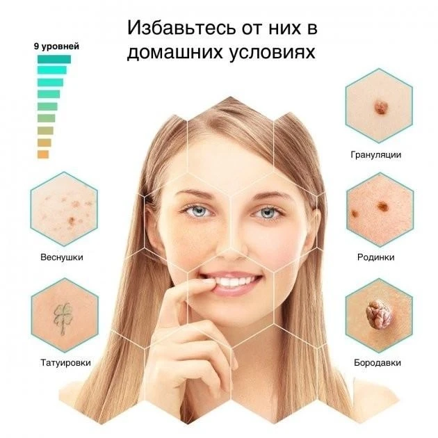 Електрокоагулятор косметологічний і плазмова ручка для видалення папілом і бородавок Nano B23 – фото 2