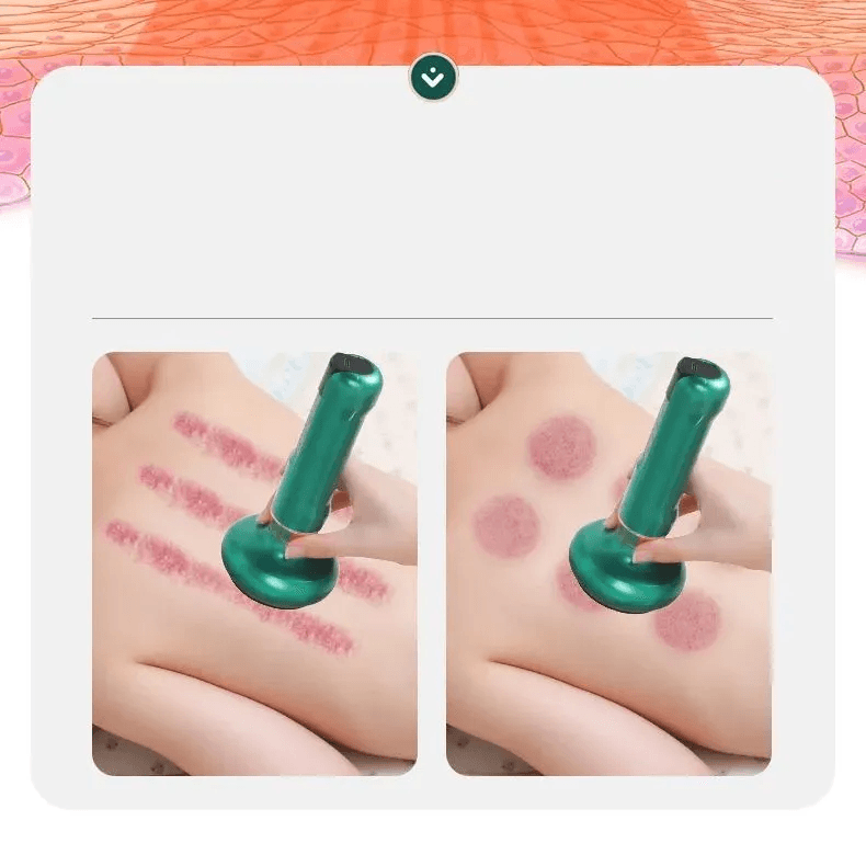 Вакуумний антицелюлітний масажер для тіла масаж гуашю Cupping Massager GREEN – фото 3